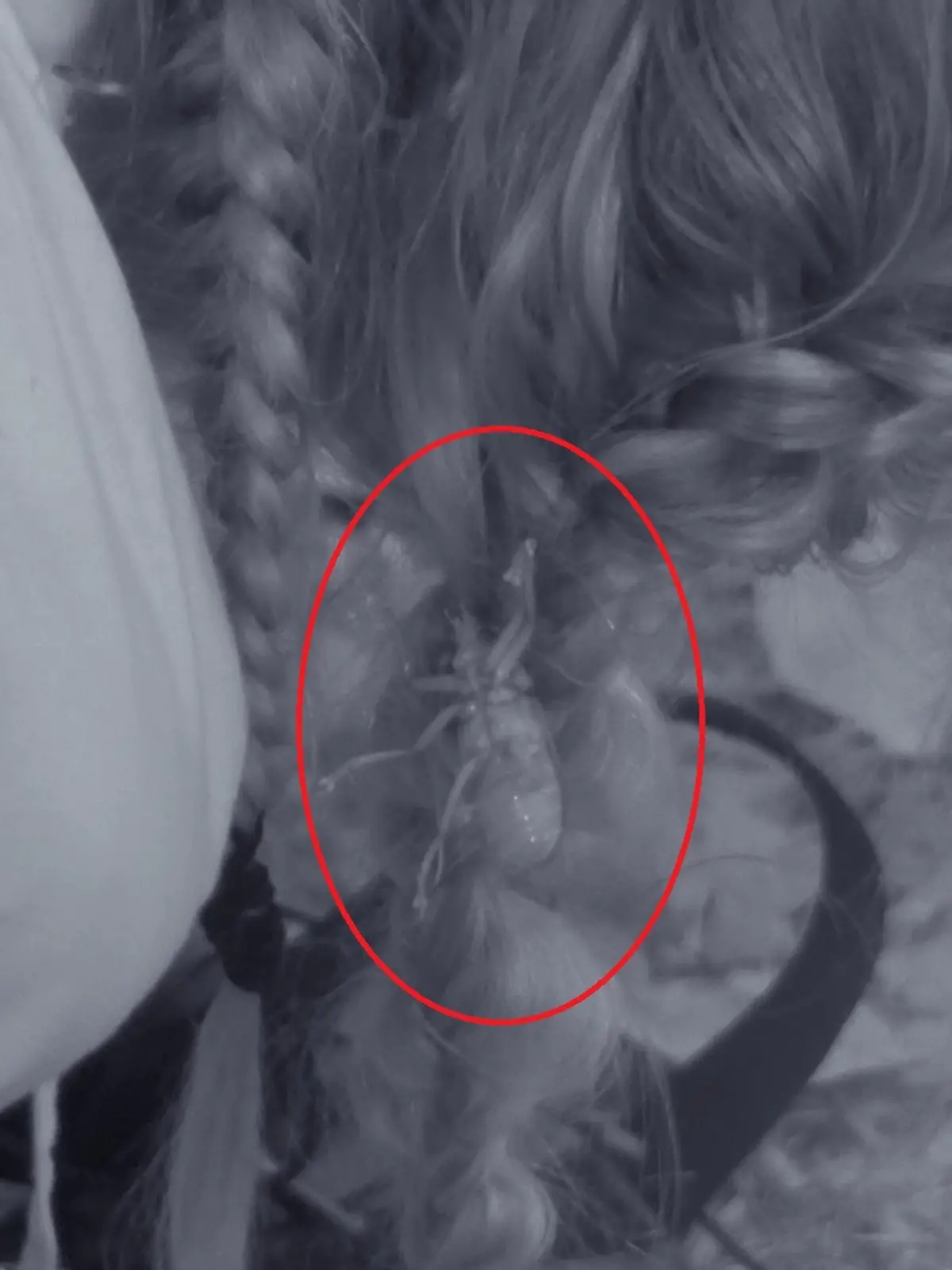 Mitten in der Nacht wurde Nicole von einem Insekt angegriffen.