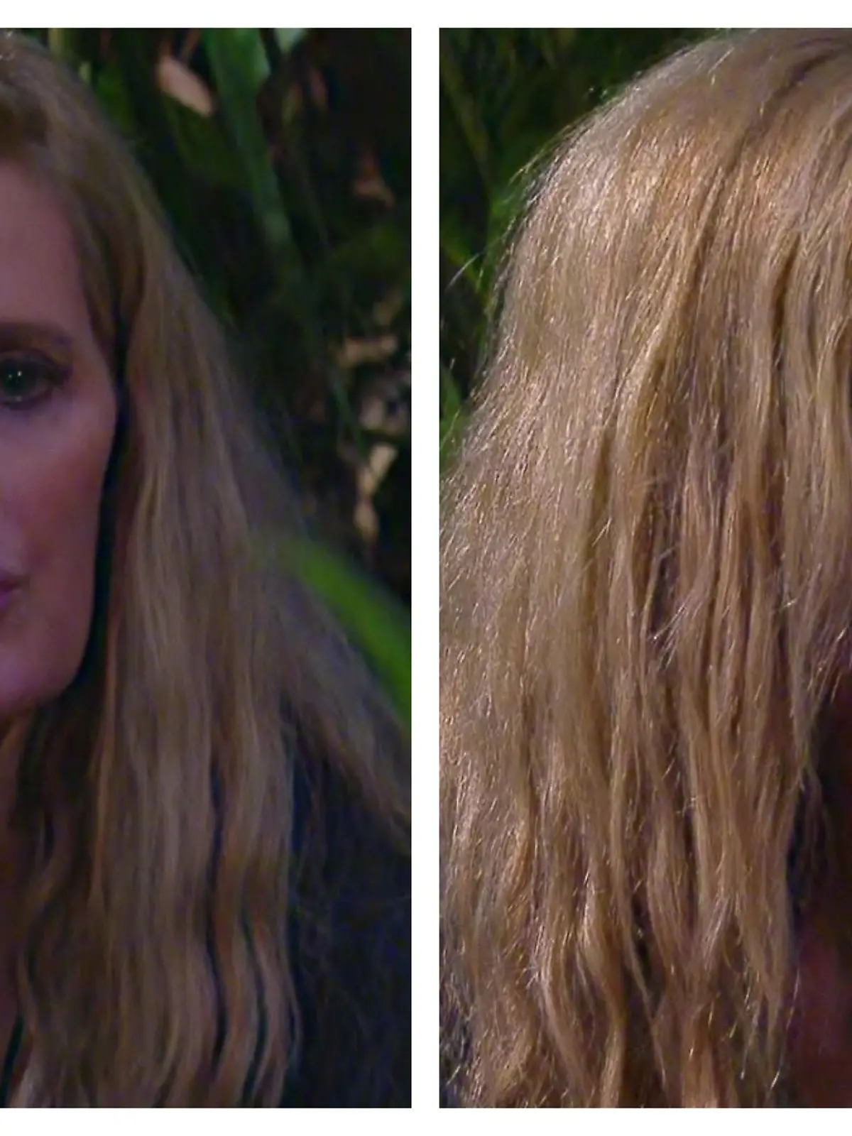 Mirja hat einen blauen Fleck auf der Lippe