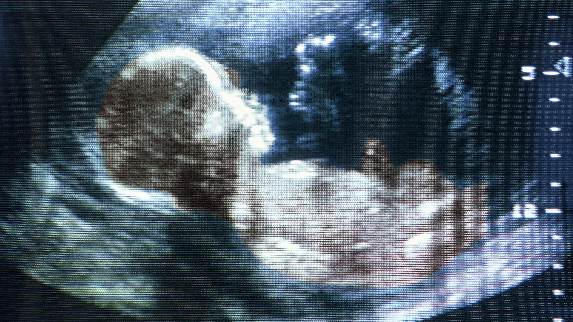 Ultraschallaufnahme eines fünf Monate alten Fötus. Undatiert.
