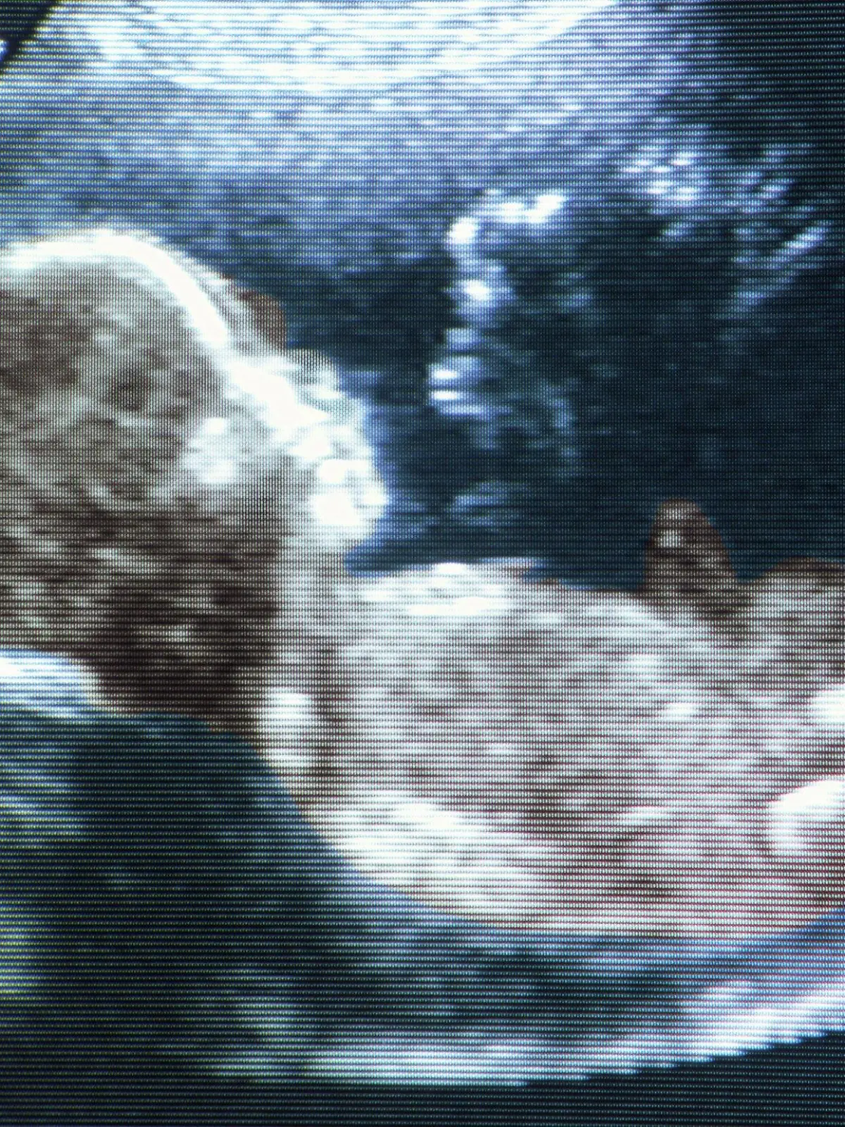 Ultraschallaufnahme eines fünf Monate alten Fötus. Undatiert.