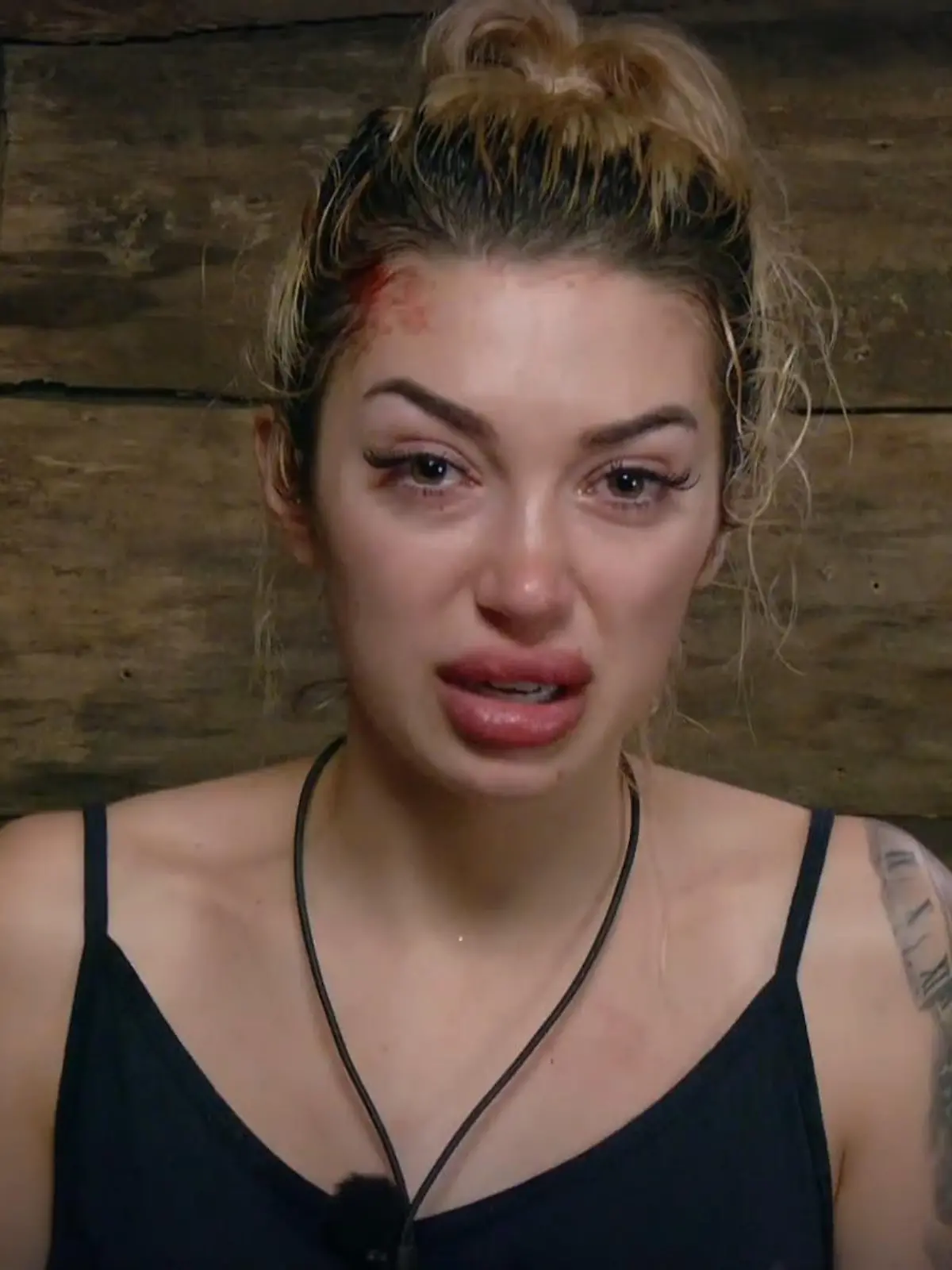 Bild zu: "Handtuch-Gate! Stinkende Handtücher und Durchfall"