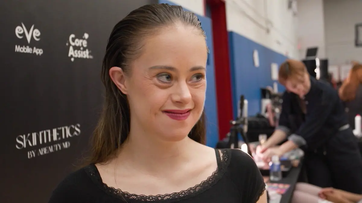 Mit-Down-Syndrom-an-die-Spitze-der-Modewelt-Chelsea-Werner-liebt-das-Leben-und-lebt-ihren-Traum