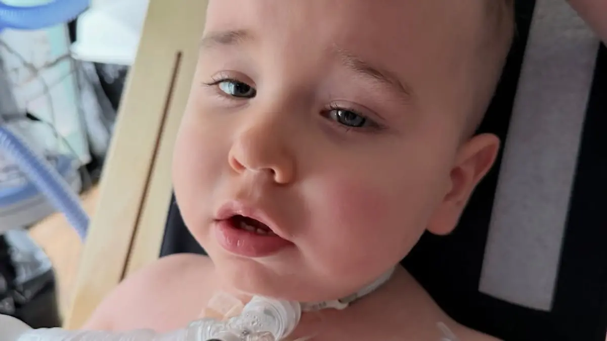 Olli (2) soll wieder allein atmen lernen 