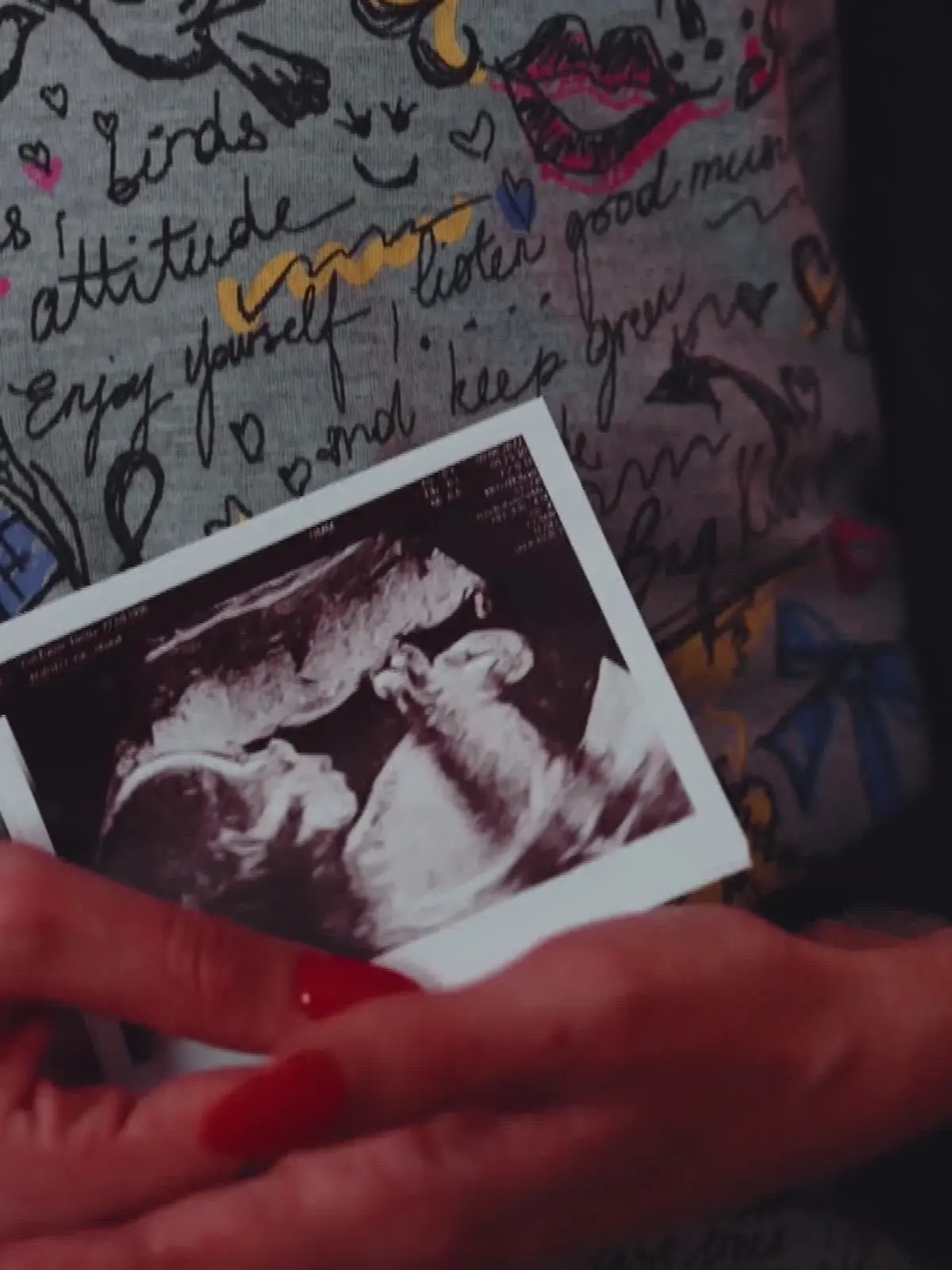 Bild zu: "Schwanger und krebskrank – Janina muss eine Entscheidung treffen"