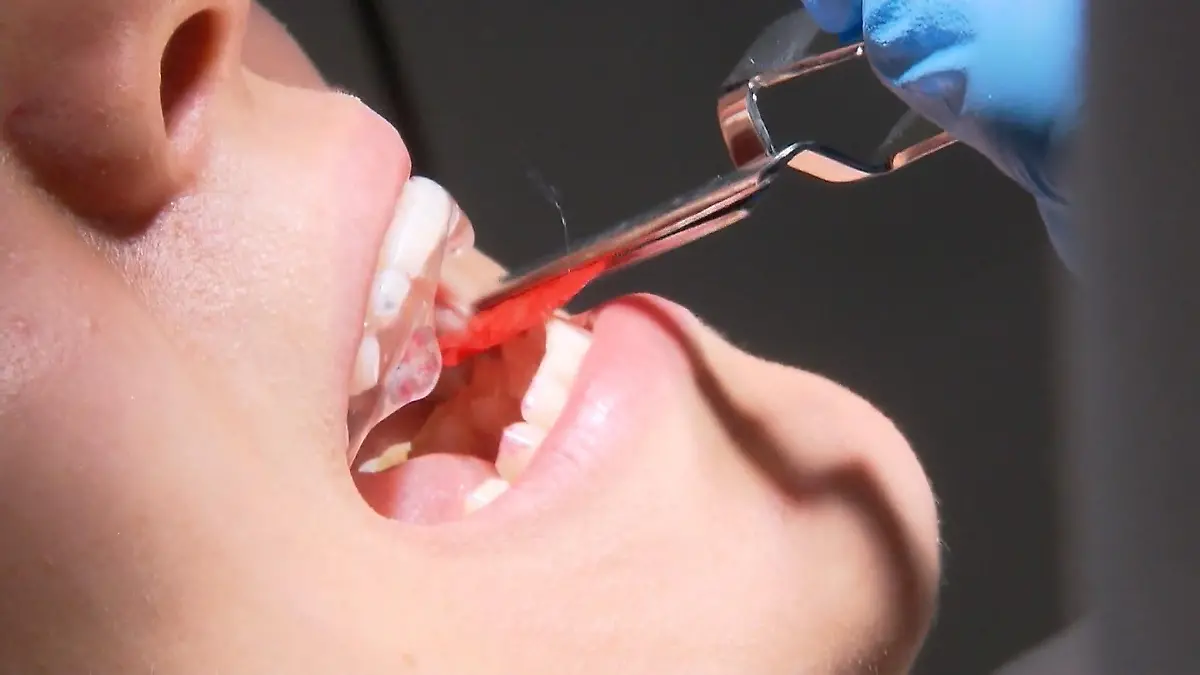 Zahnarztbesuch bald Luxus? Sozialstaat-Debatte