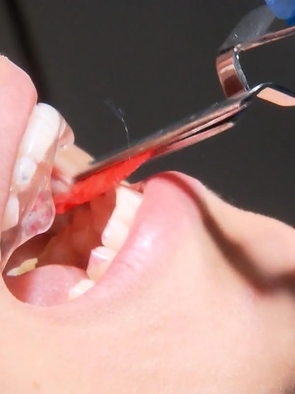 Bild zu: "Zahnarztbesuch bald Luxus?"