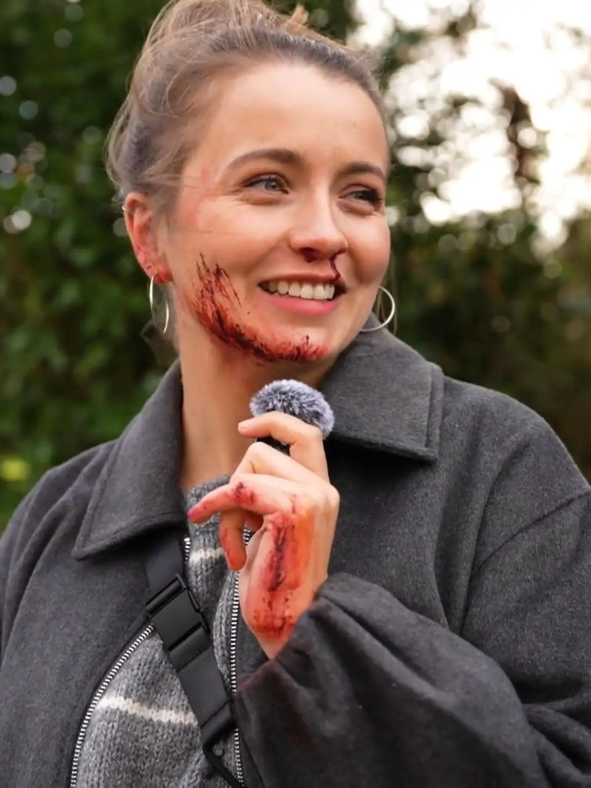 Bild zu: "So wurde Lucies Unfall am AWZ-Set inszeniert!"