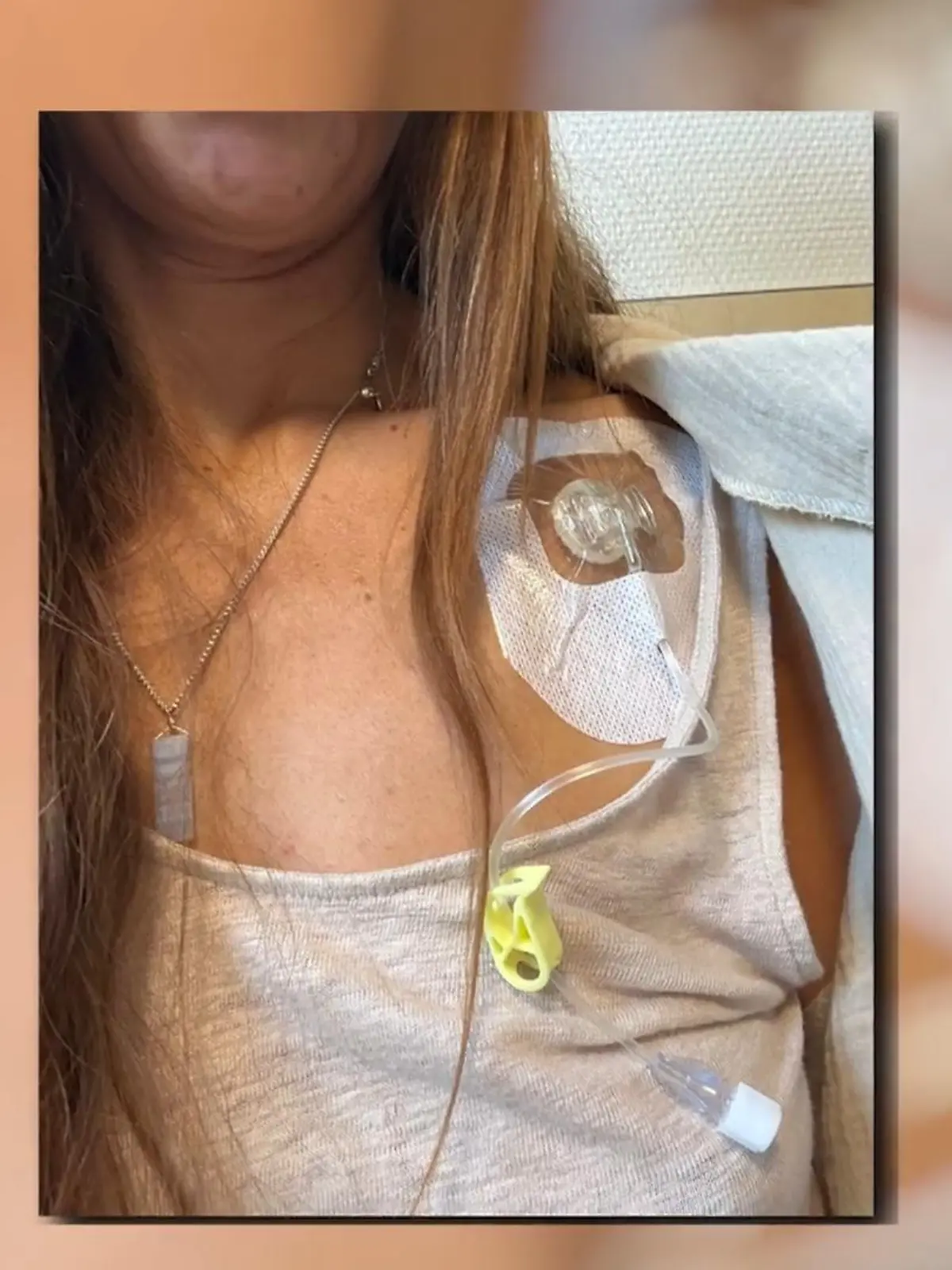 Bild zu: "Jaqueline (40) und der Brustkrebs"