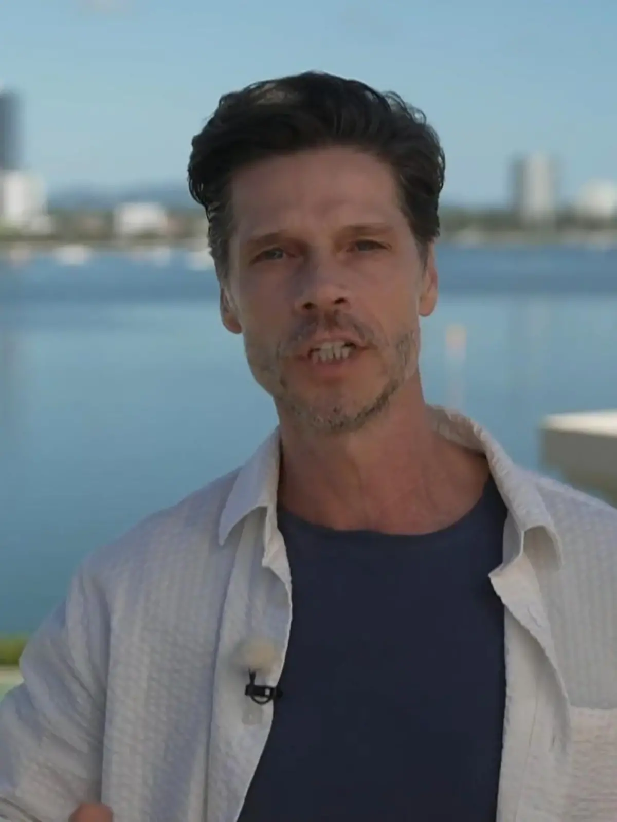 Bild zu: "Stephen Dürr wehrt sich gegen die Bikini-Vorwürfe - „Das ist nicht in Ordnung!“"