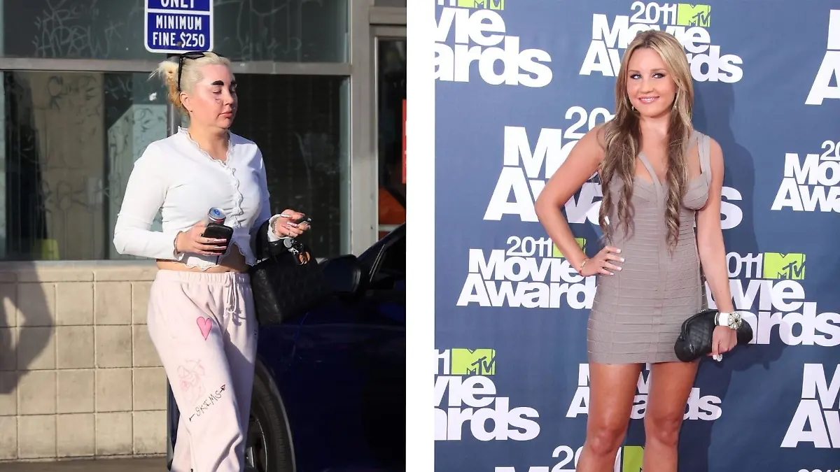 In den vergangenen 20 Jahren hat sich Amanda Bynes stark verändert. 