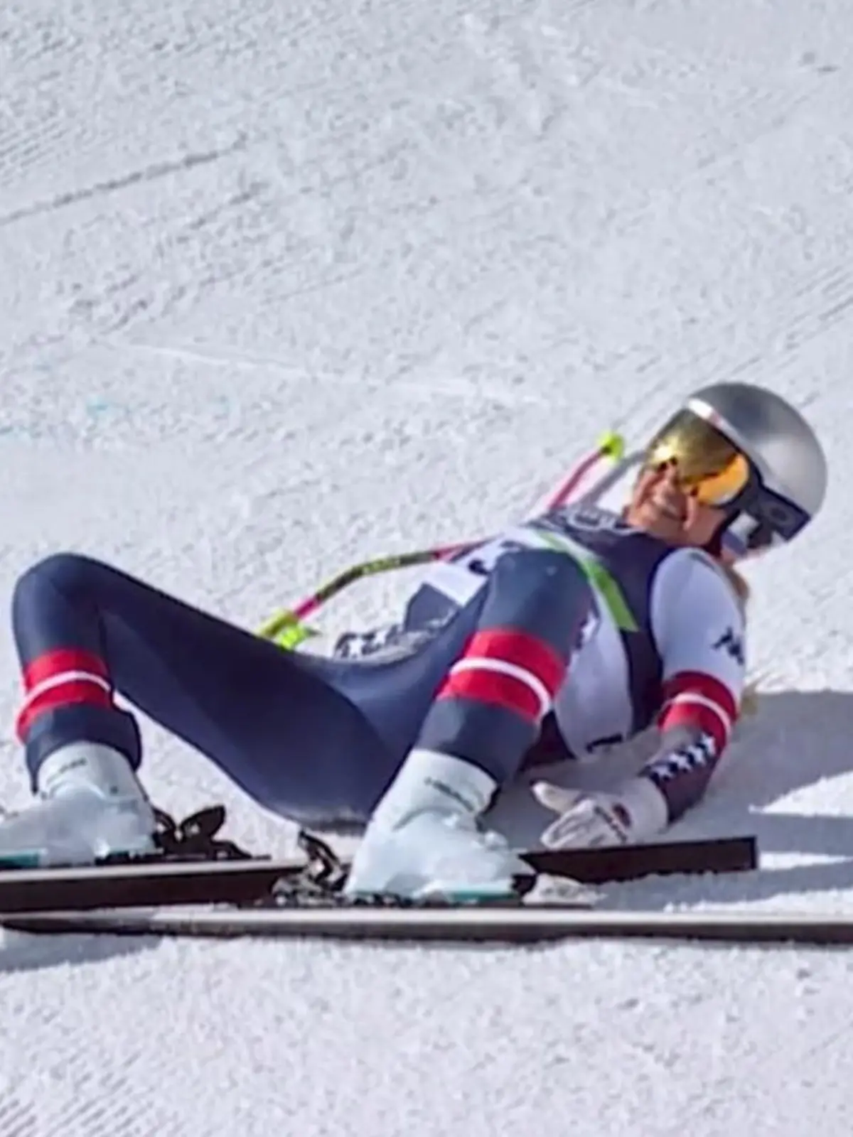 Bild zu: "„Kann zur Amputation führen" – Arzt ordnet Lindsey Vonns Verletzungen ein!"