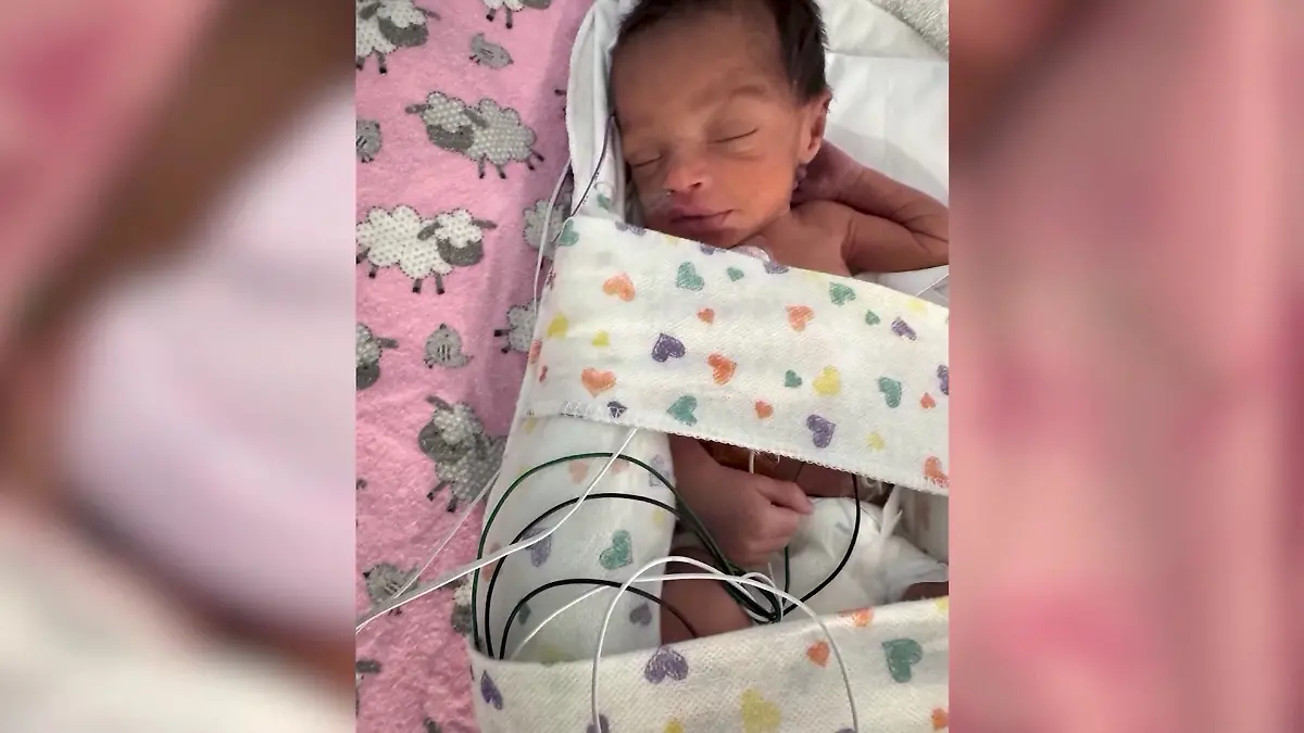 Ivory Sully wird nach einem Autounfall ihrer Mutter per Kaiserschnitt ge