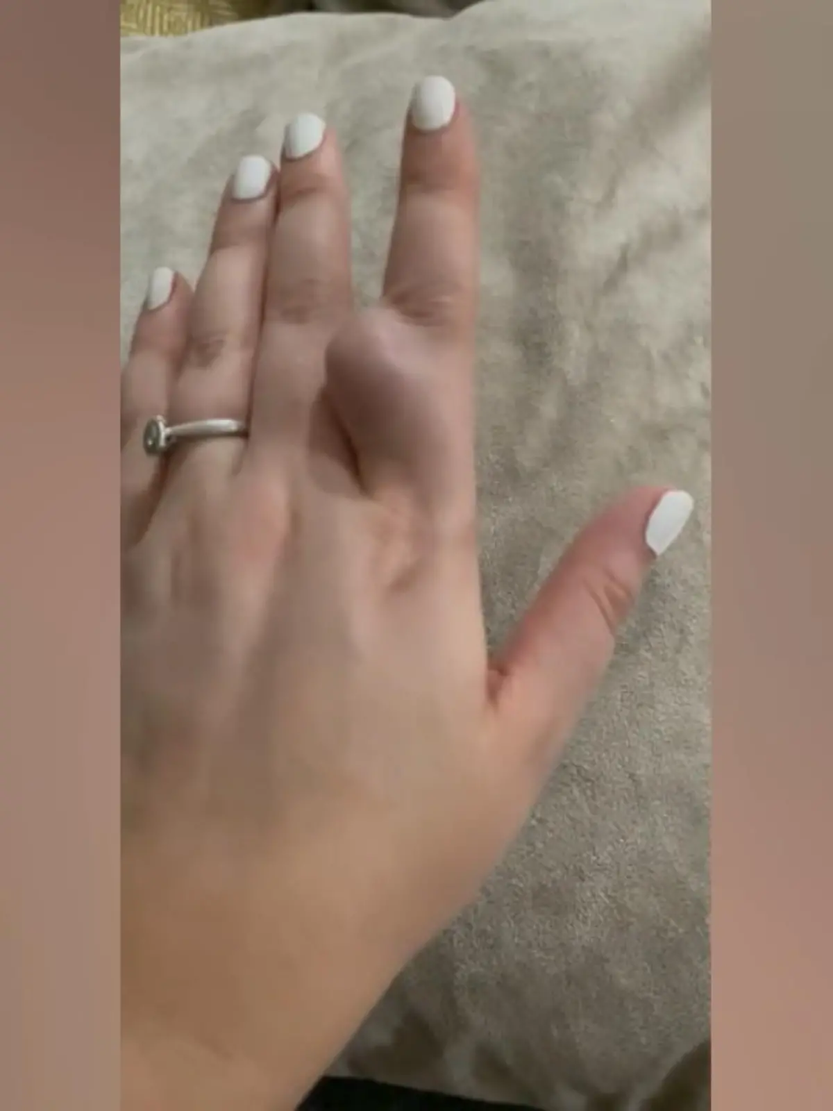 Bild zu: "Frau hat einen "schwangeren Finger""