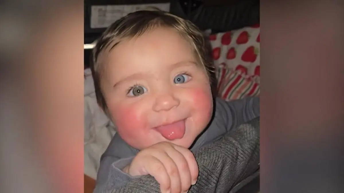 Überraschung nach der Geburt! Baby Valyn hat verschiedene Augen-, Haar- und Hautfarben Seltene DNA-Störung?