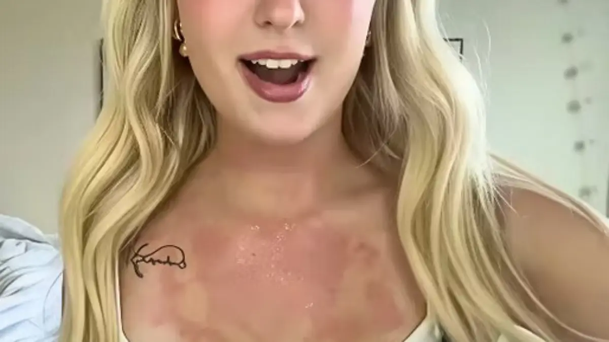 Schon nach kurzer Zeit wird ein vermeintlicher Ausschlag sichtbar