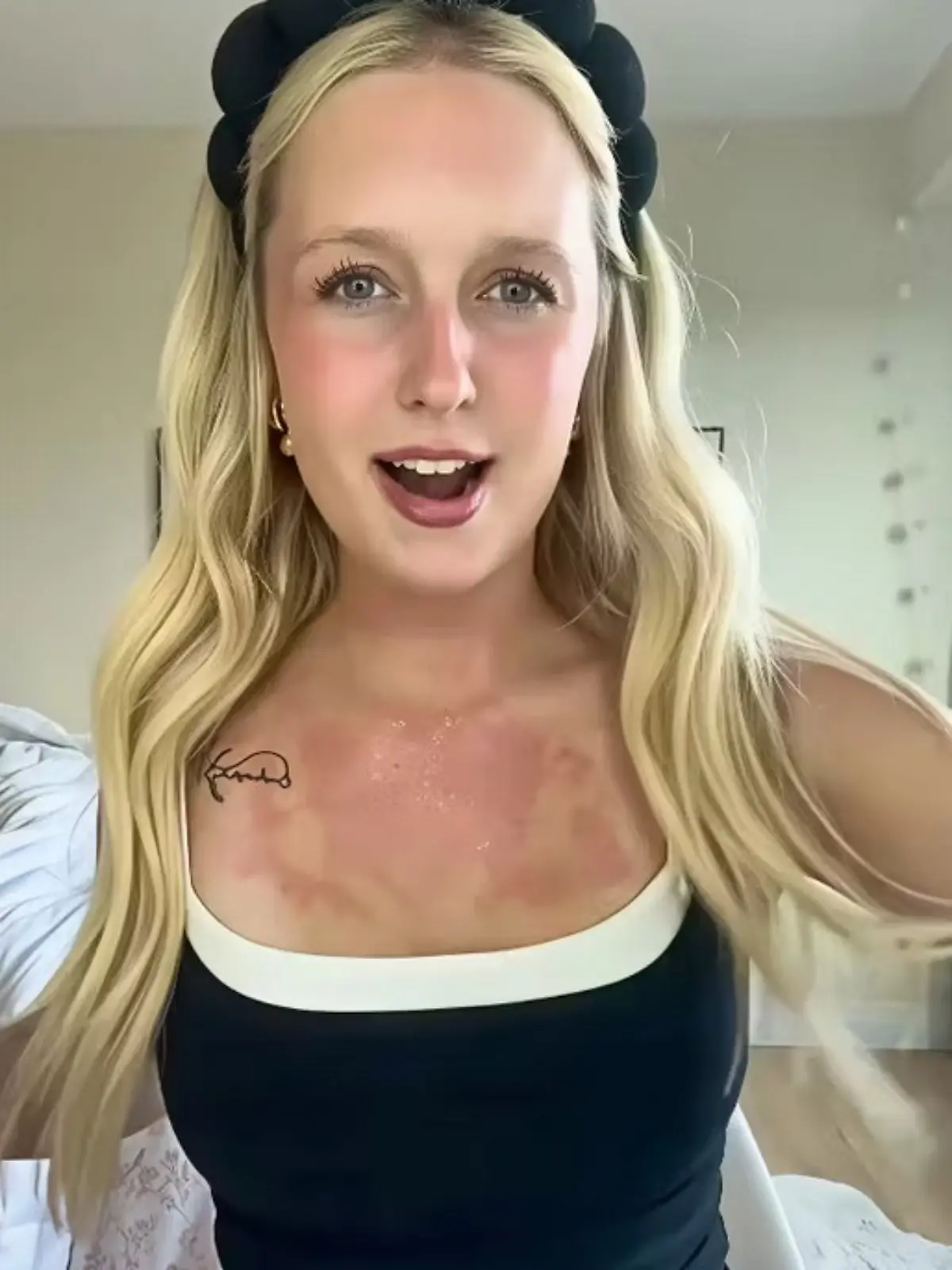 Schon nach kurzer Zeit wird ein vermeintlicher Ausschlag sichtbar