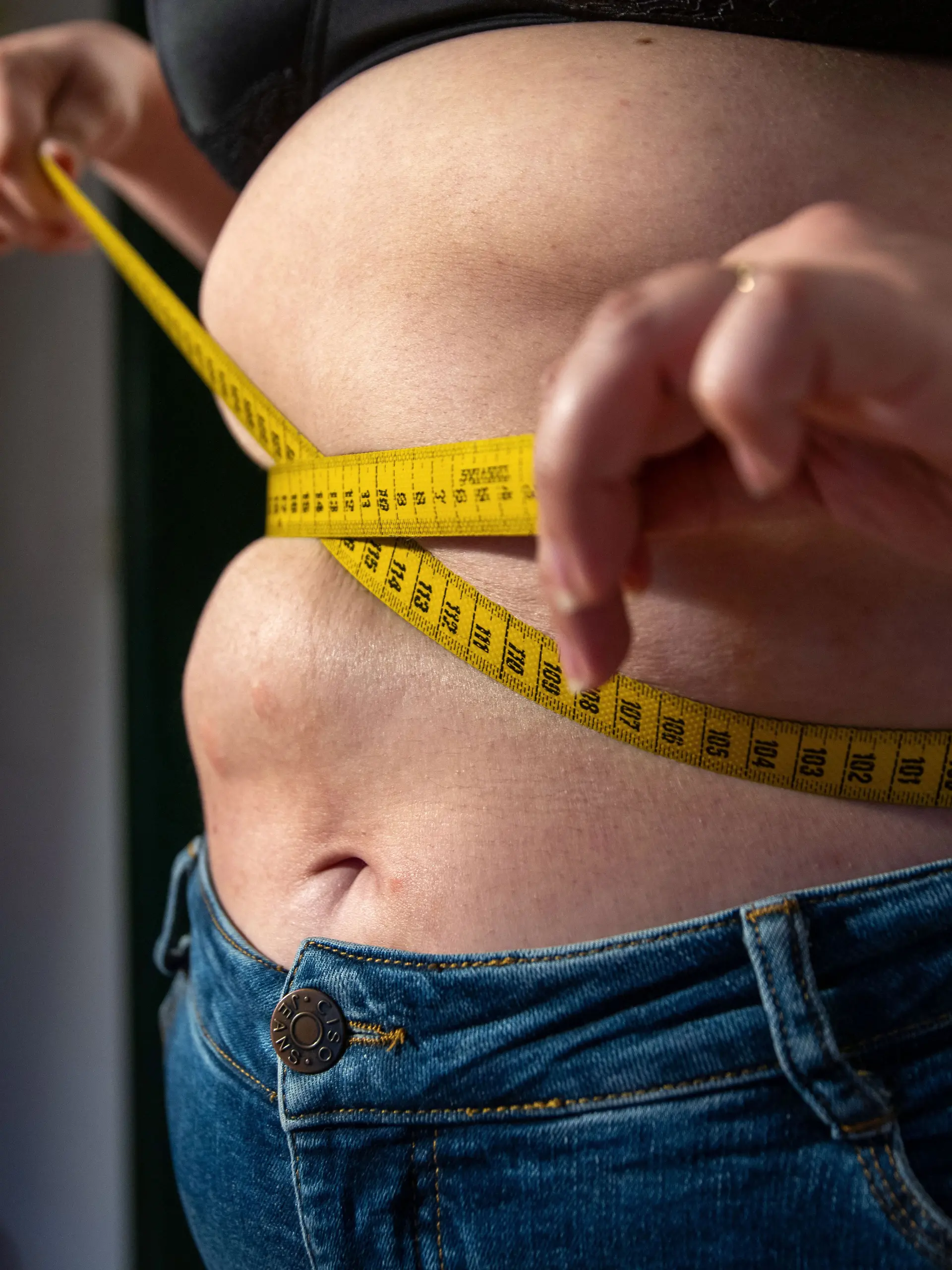 Ein Maßband um einen dicken Bauch (Symbolbild)