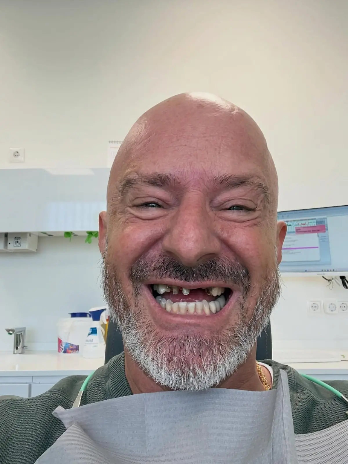 Bild zu: "„Mut zur Lücke!” „Hot oder Schrott“-Star Detlef Steves zeigt sich zahnlos"