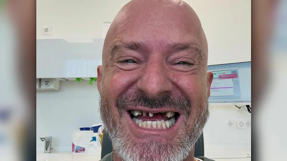 Hot oder Schrott“-Star Detlef Steves zeigt sich zahnlos Mut zur Lücke