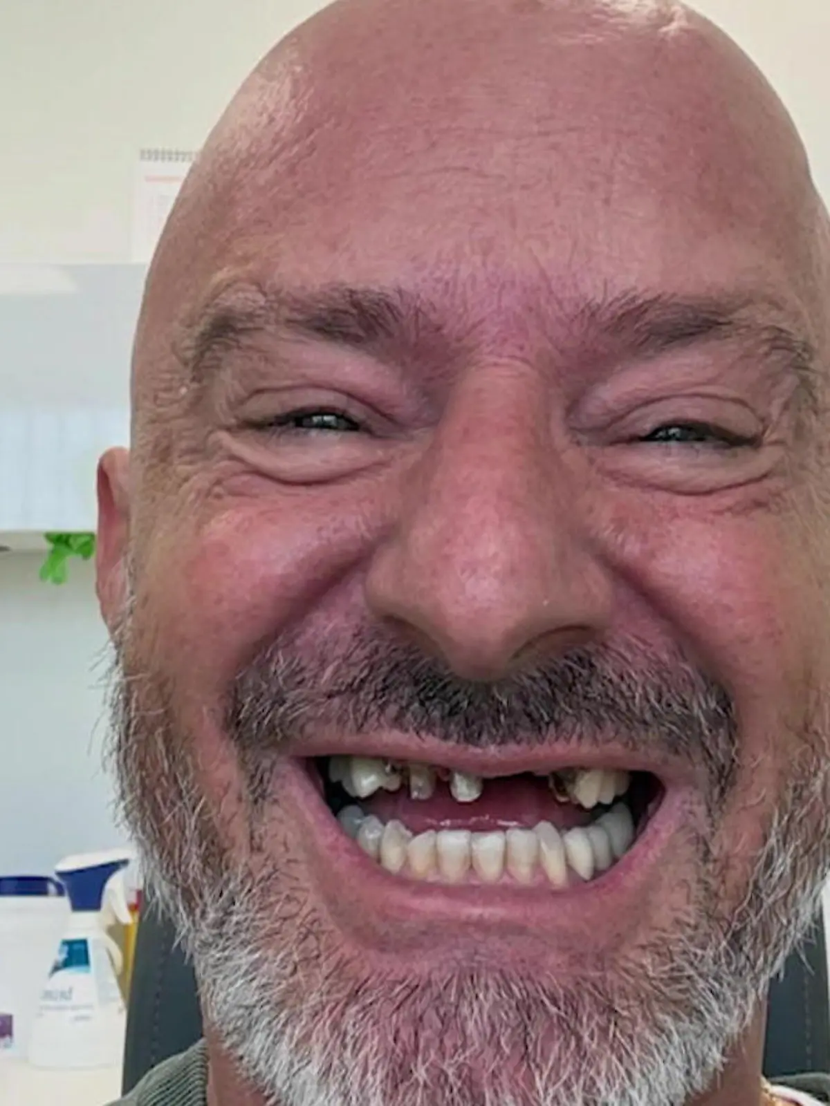 Bild zu: "Hot oder Schrott“-Star Detlef Steves zeigt sich zahnlos"