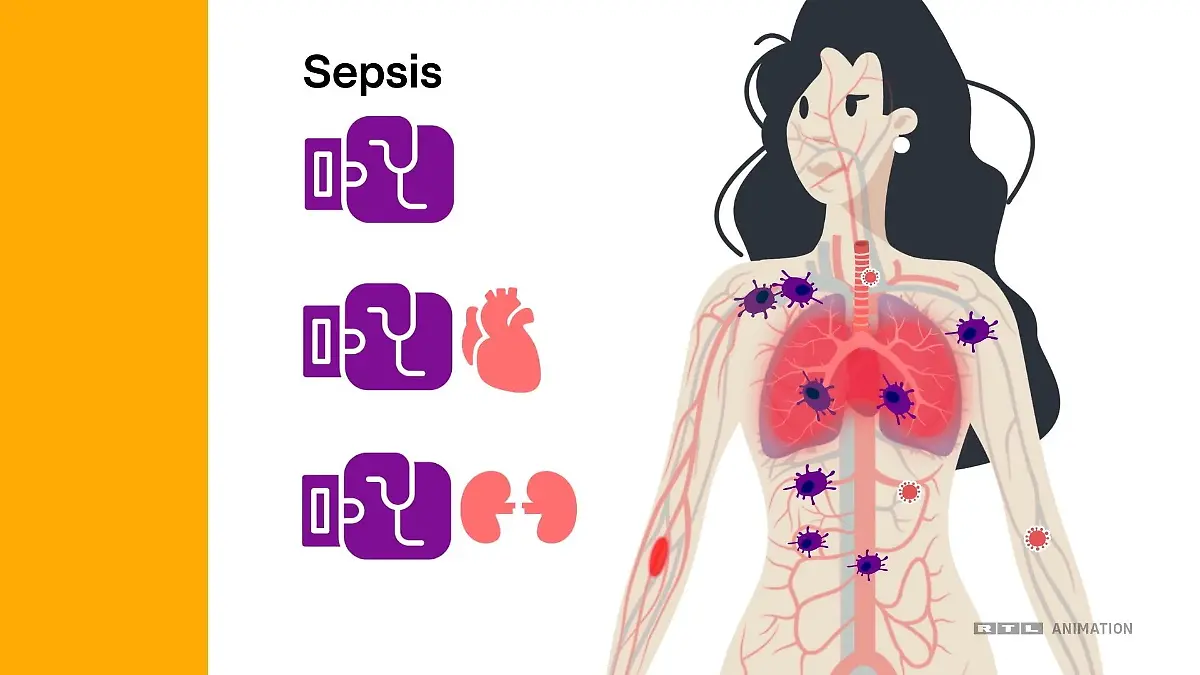 Sepsis-Drama bei GZSZ – das müsst ihr über die dritthäufigste Todesursache wissen! Lebensgefährliche Blutvergiftung