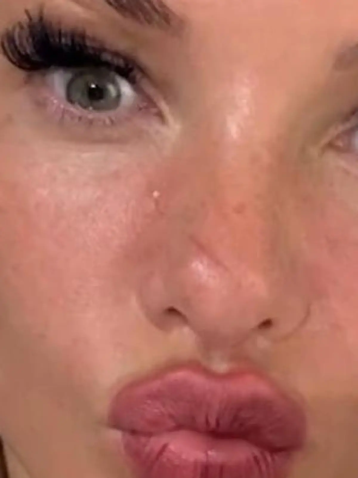 Bild zu: "Autsch, Evelyn! Was ist mit deinem Gesicht passiert?"