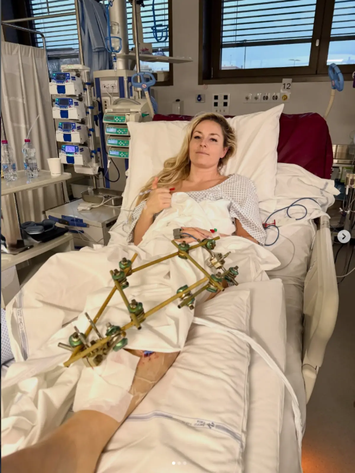 Bild zu: "Nach Horror-Sturz bei Olympia! Lindsey Vonn stand kurz vor Amputation"