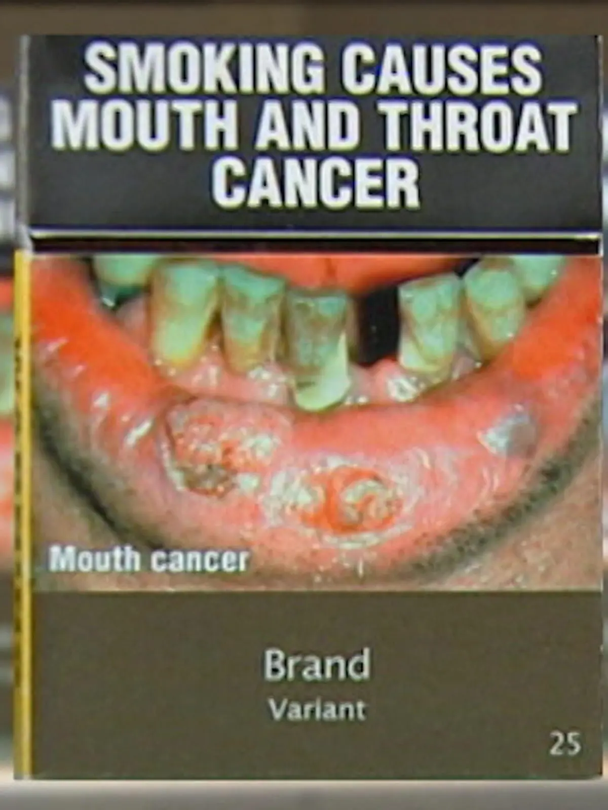 Bild zu: "10 Jahre Schockfotos auf Zigaretten: Bringen sie etwas?"