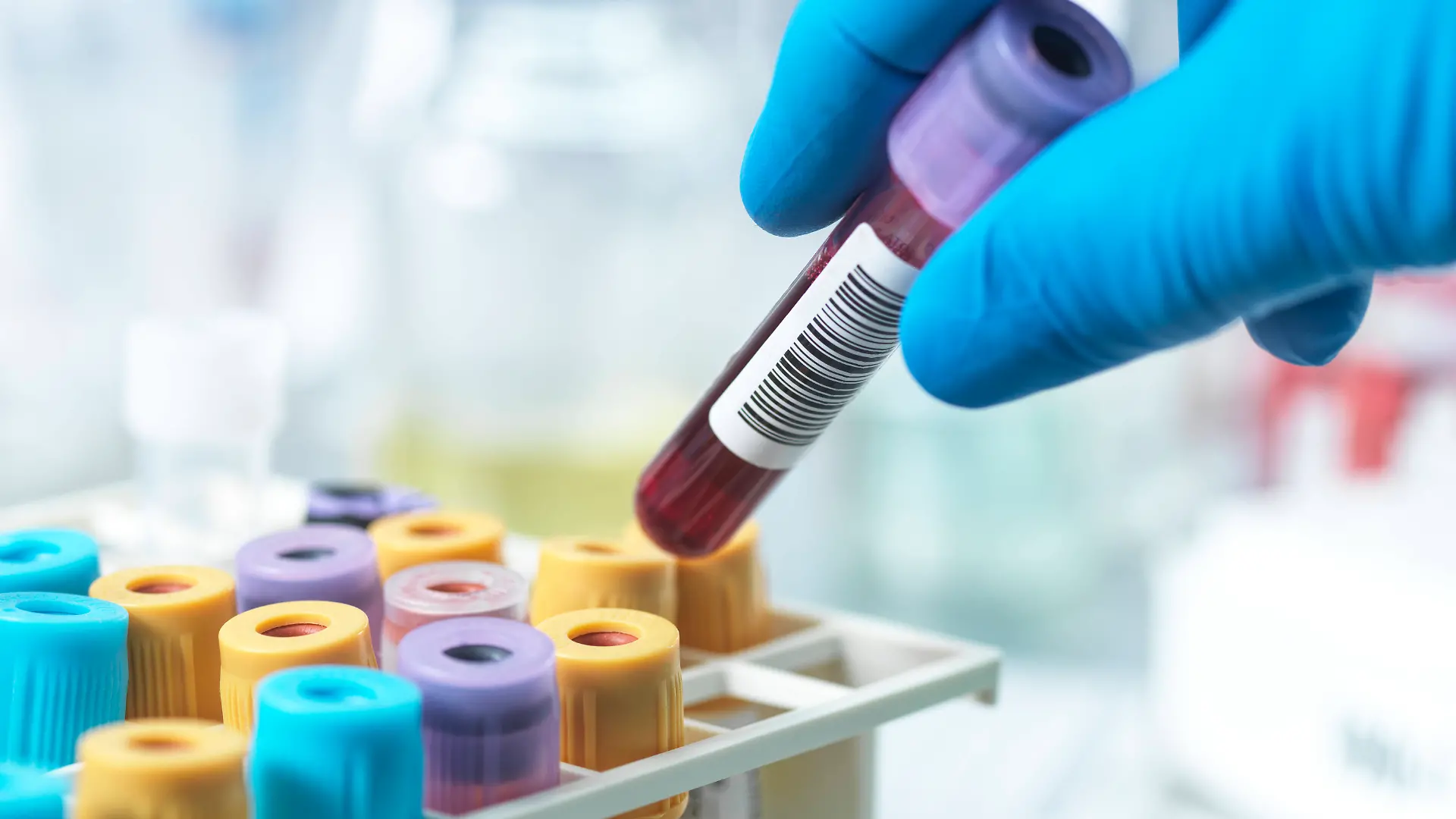 Im Blut der Hundertjährigen fanden die Forschenden Proteine, die Stress vermindern.