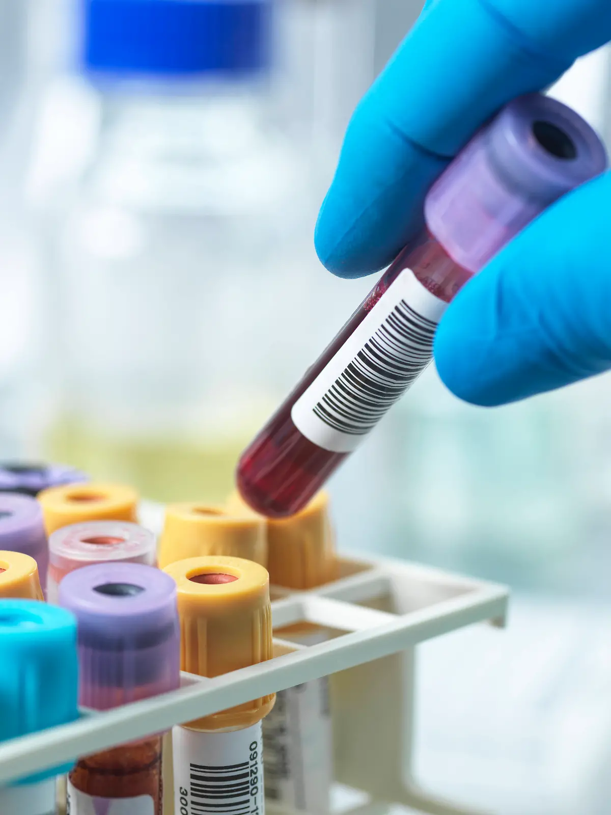 Im Blut der Hundertjährigen fanden die Forschenden Proteine, die Stress vermindern.