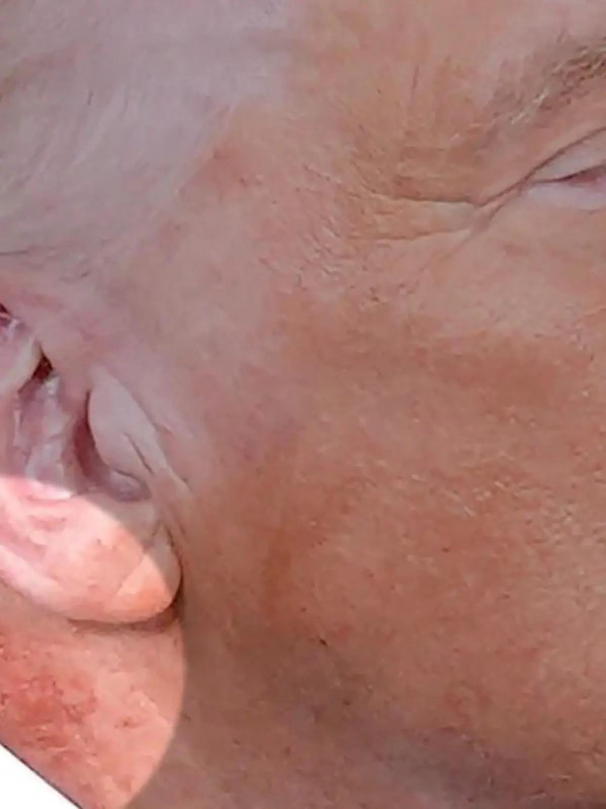 Bild zu: "Mysteriöser Fleck am Hals! Nächstes Gesundheitsrätsel um Donald Trump"