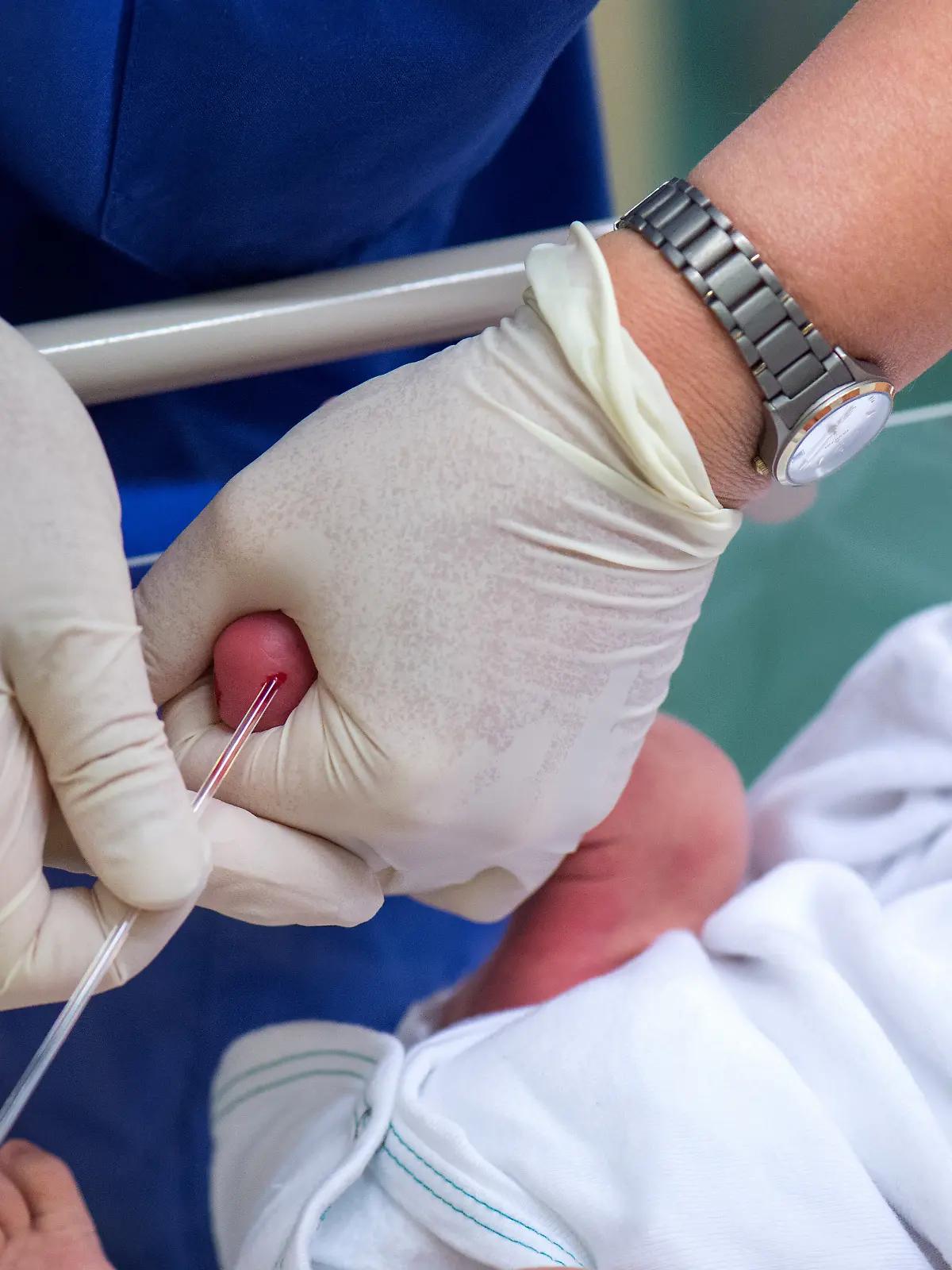 Eine Krankenschwester entnimmt am 22.08.2016 einem Säugling auf der Wochenstation des Kinder-Frauenzentrums im Universitätsklinikum Carl Gustav Carus in Dresden (Sachsen) an der Ferse Blut für ein Mukoviszidose-Screening. Bei Neugeborenen werden mit einer Blutabnahme die Vererbungsmerkmale untersucht. Foto: Arno Burgi/dpa (zu dpa «Pk zur Studie zur Typ-1-Diabetes-Früherkennungsuntersuchung bei Neugeborenen» vom 26.08.2016) ++