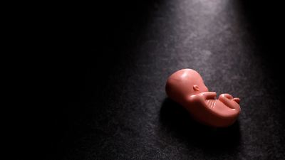 Youtuber-Paar treibt Baby mit Downsyndrom ab – und bekommt M