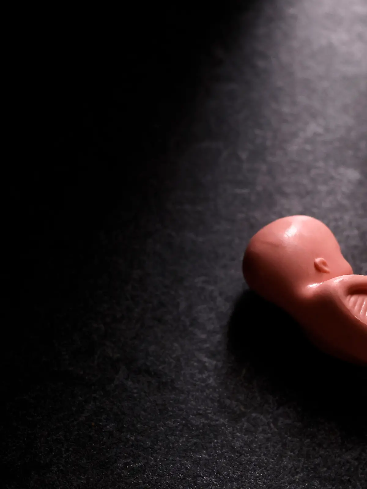 Schwangerschaftsabbruch