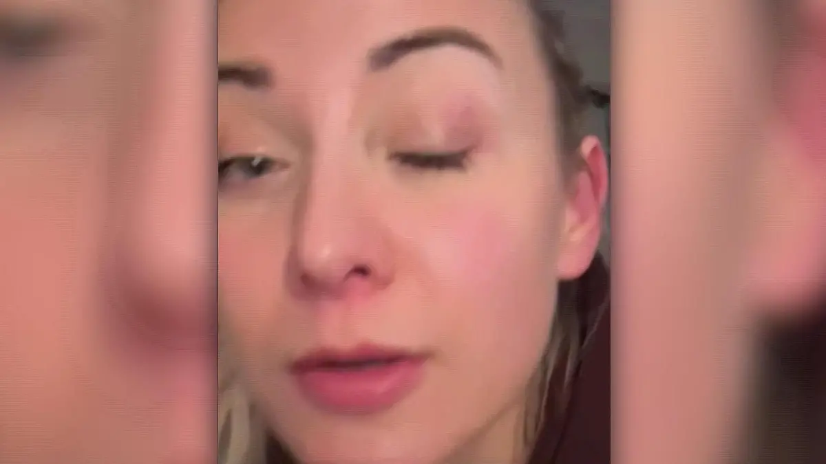 Die Promis haben bereits erste Verletzungen Noch vor der 1. „Let’s Dance”-Show