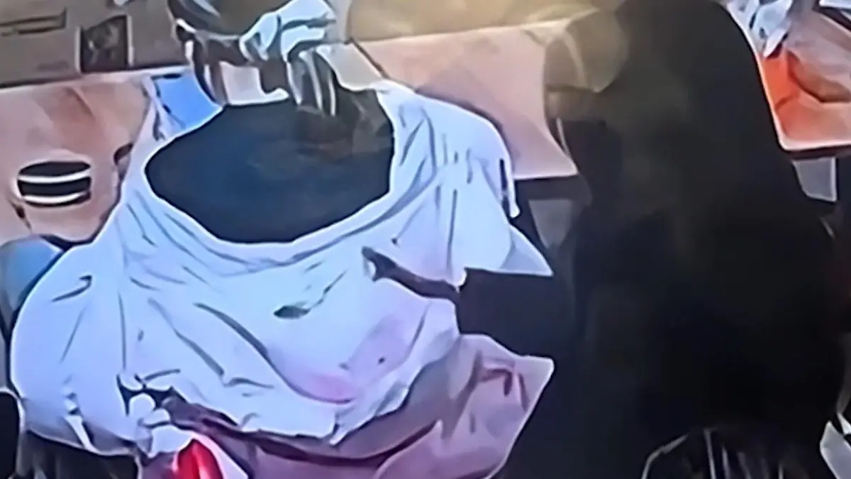 Frau kippt Schneckensuppe in Kapuze von Sitznachbarin – um sie DAFÜR zu bestrafen! Schleimige Rache! 