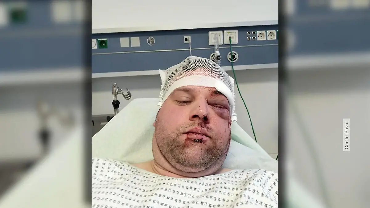 DRK-Mitarbeiter ins Krankenhaus geprügelt Attacke in Bochum