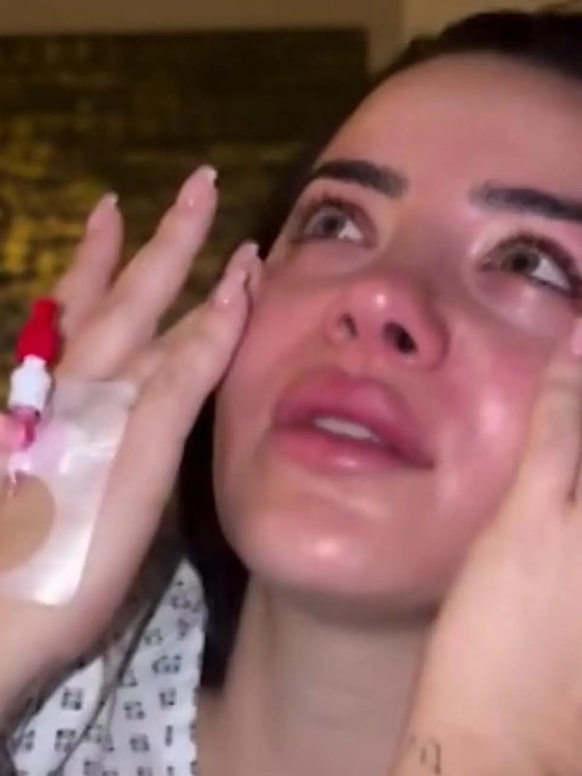 Bild zu: "Leyla Heiter in Lebensgefahr wegen Beauty-OP-Komplikationen"