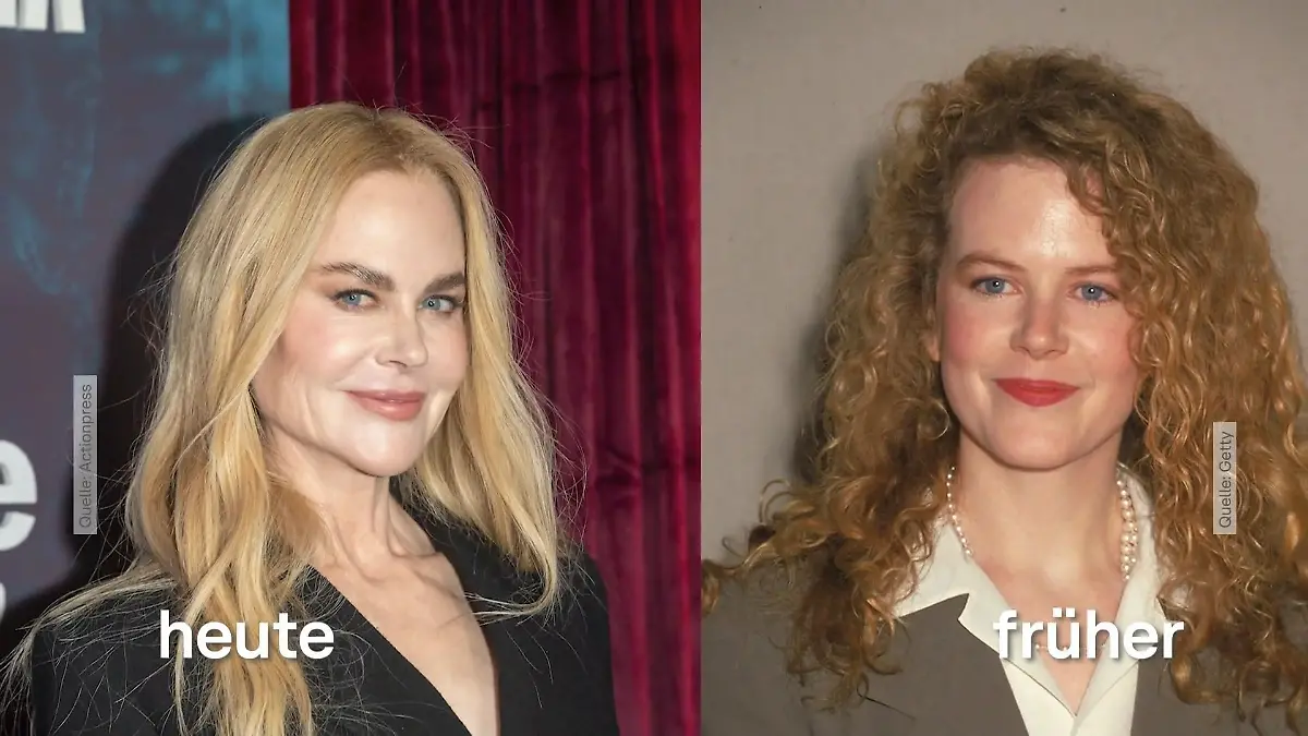 Jugendwahn bei den Stars Hollywood und Anti Aging