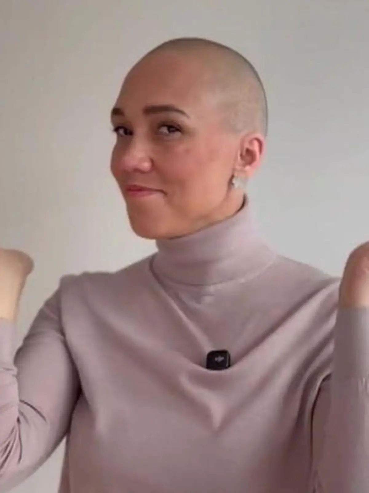 Bild zu: "FDP-Politikern muss sich Glatze rasieren – wegen DIESER Wette!"