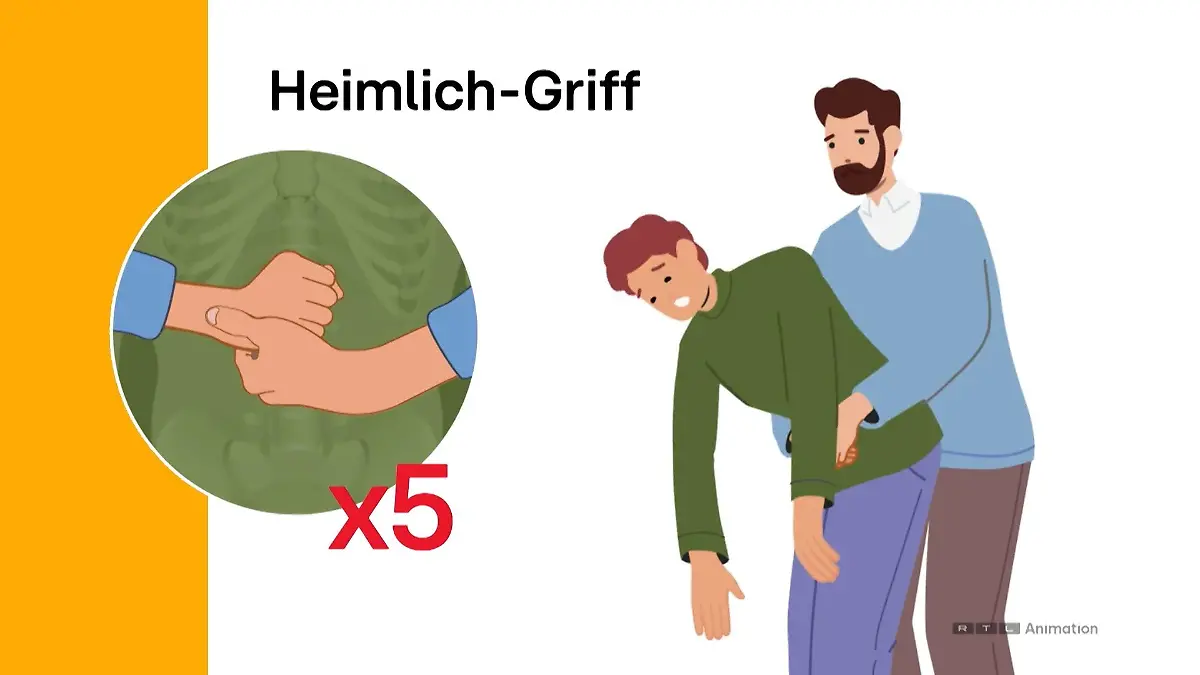 Heimlich-Griff rettet Leben! So einfach geht's Erste-Hilfe-Maßnahme