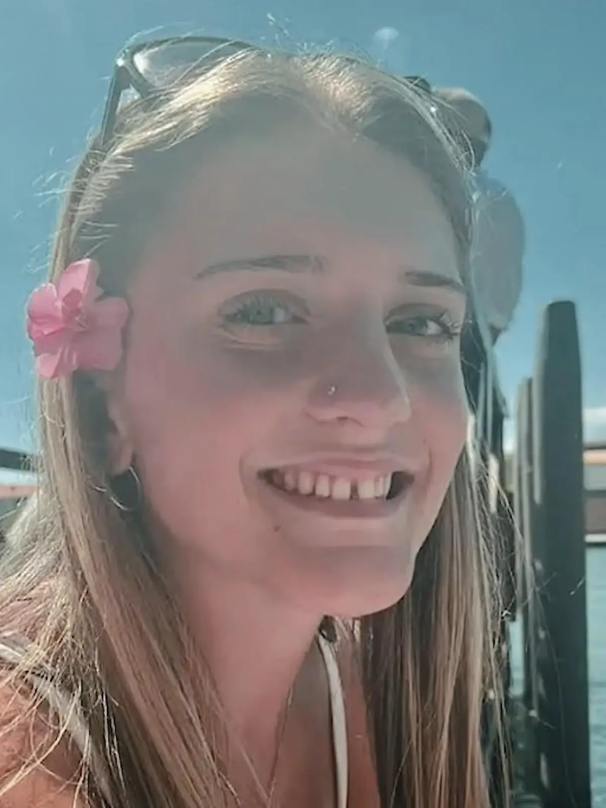 Bild zu: "Juliette (18) stirbt bei Meningitis-Ausbruch in England"