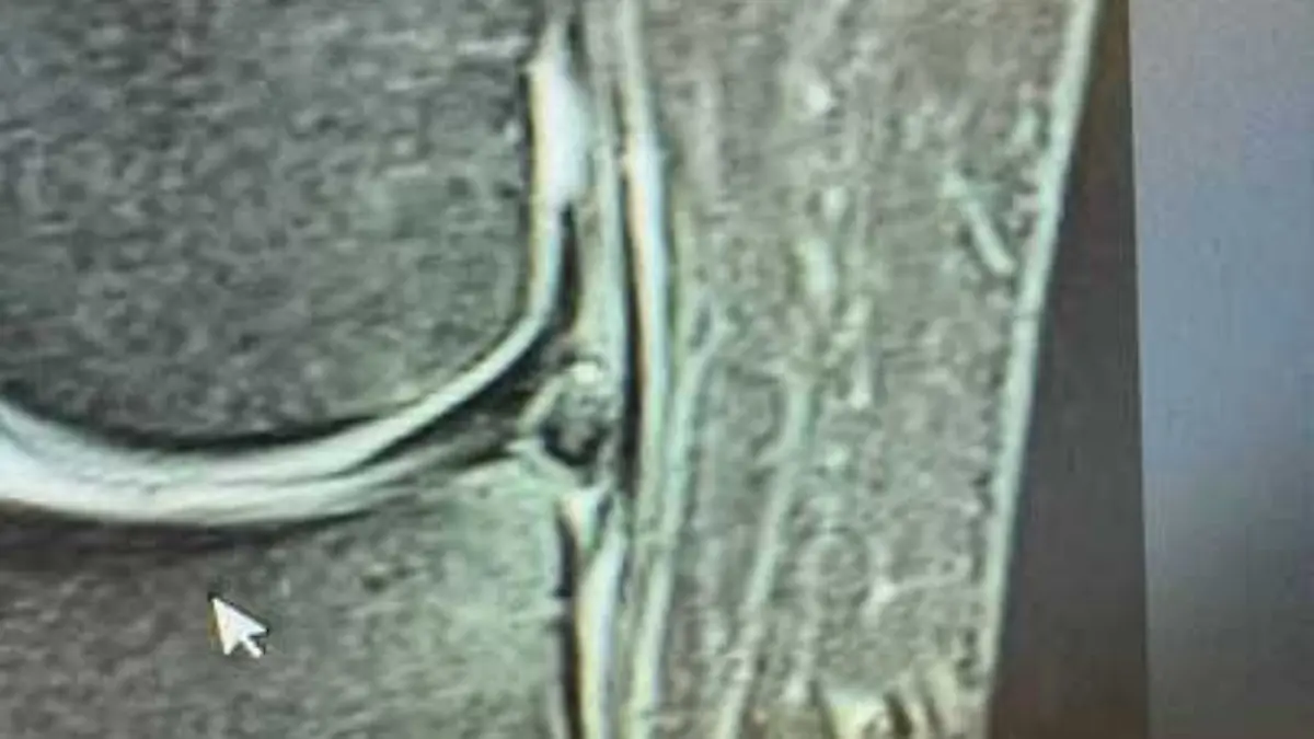 Hubert Fella hat noch Probleme mit einem Meniskussriss im Knie. 