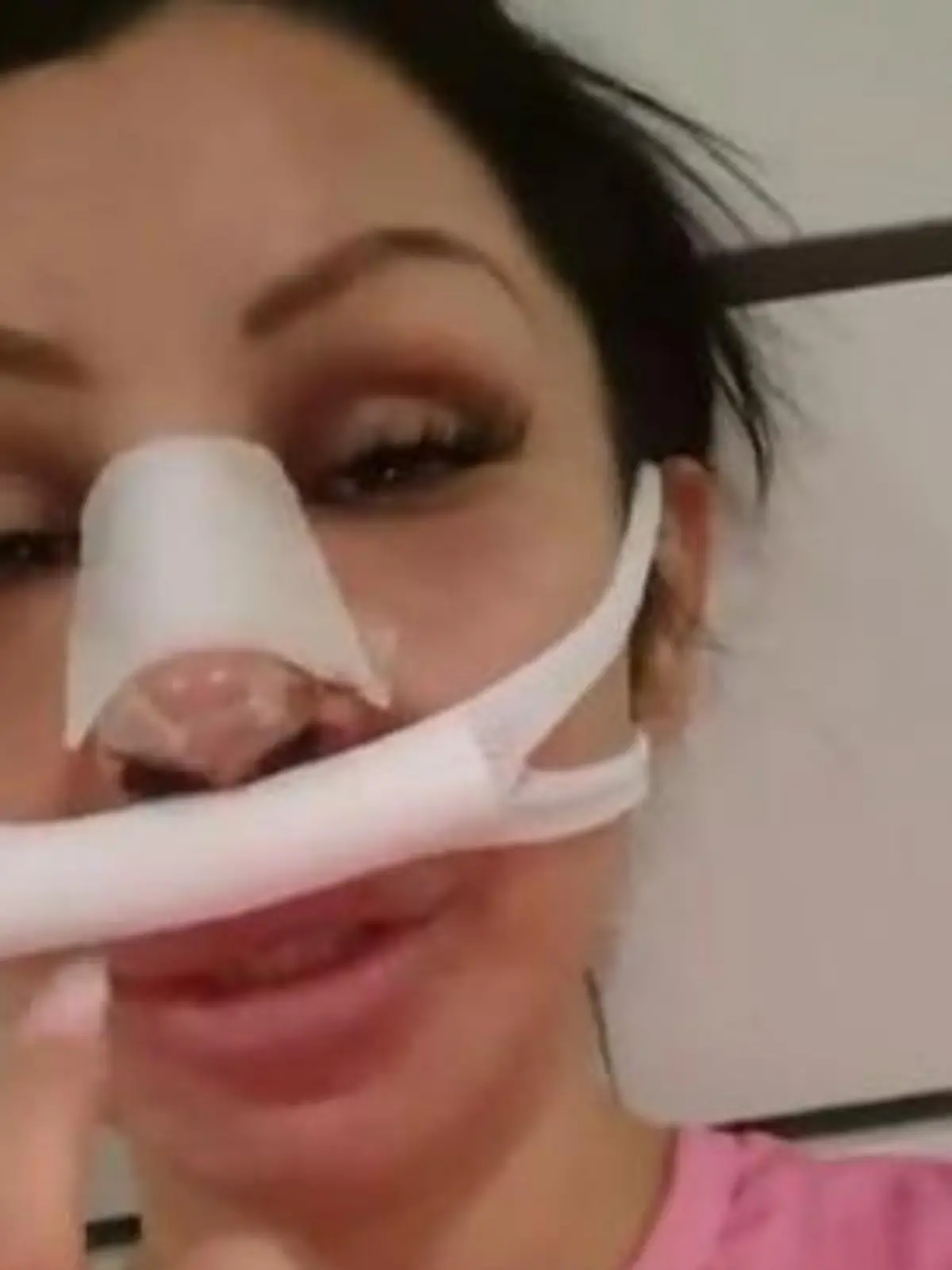 Bild zu: "Kurz nach Schönheits-OP! Reality-Star passiert schmerzhaftes Missgeschick"