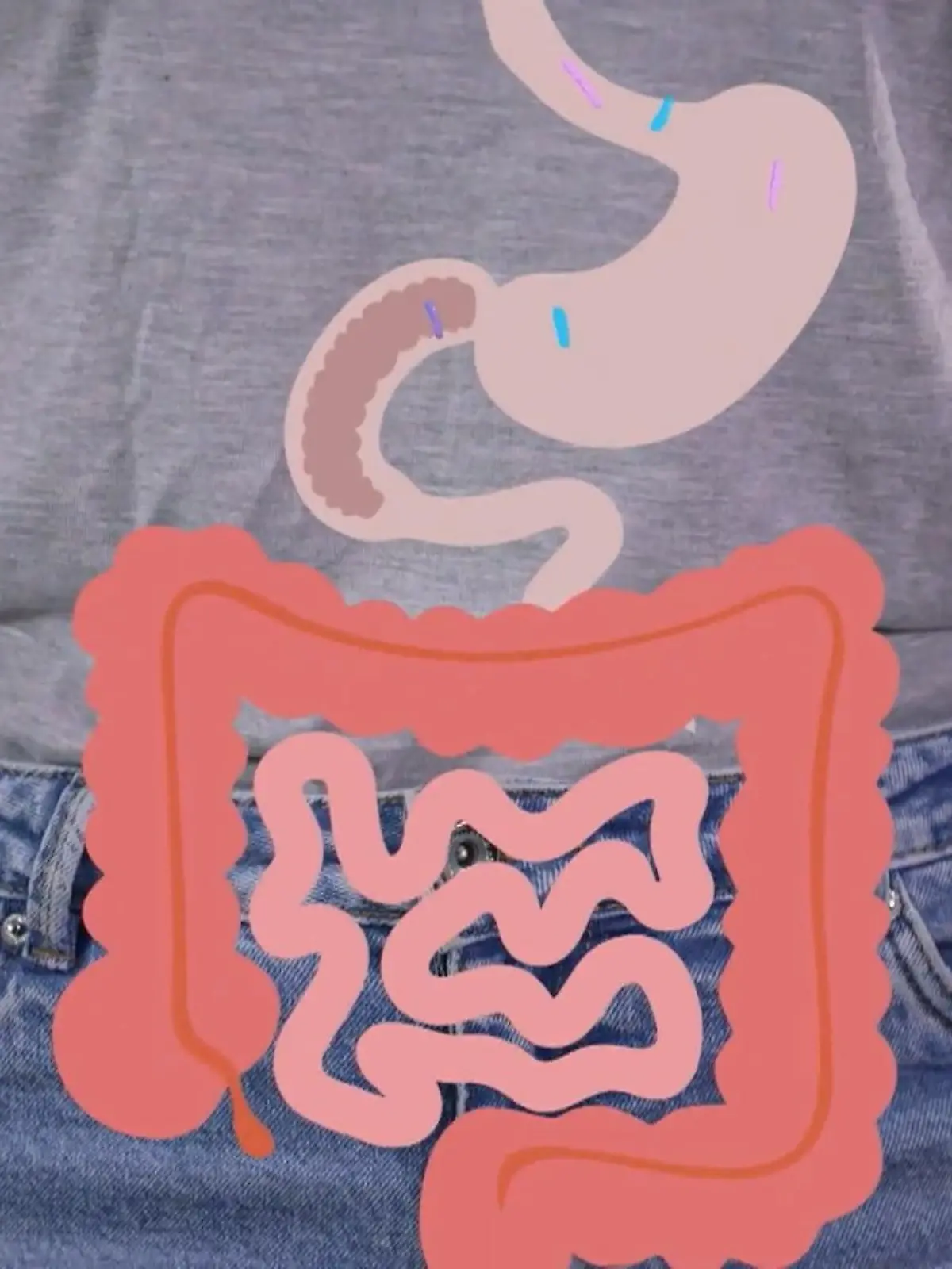 Bild zu: "Zerstören Antibiotika unseren Darm?"