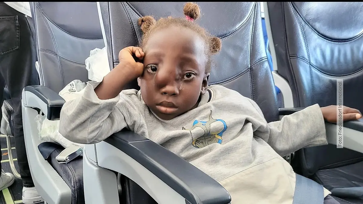 Geodimara (6) hatte eine Lücke im Schädelknochen Von Angola ins Ruhrgebiet