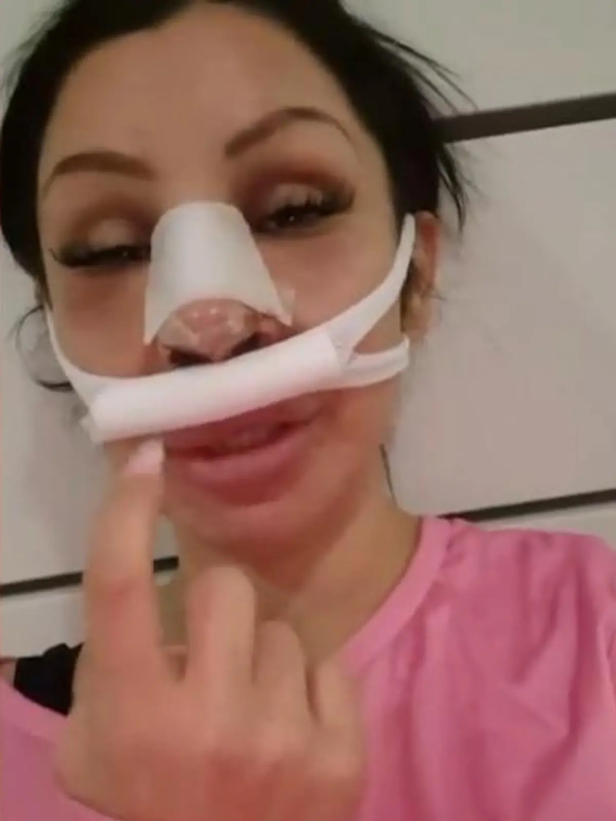 Reality-Star Pinar Sevim zeigt sich direkt nach ihrer zweiten Nasen-OP.