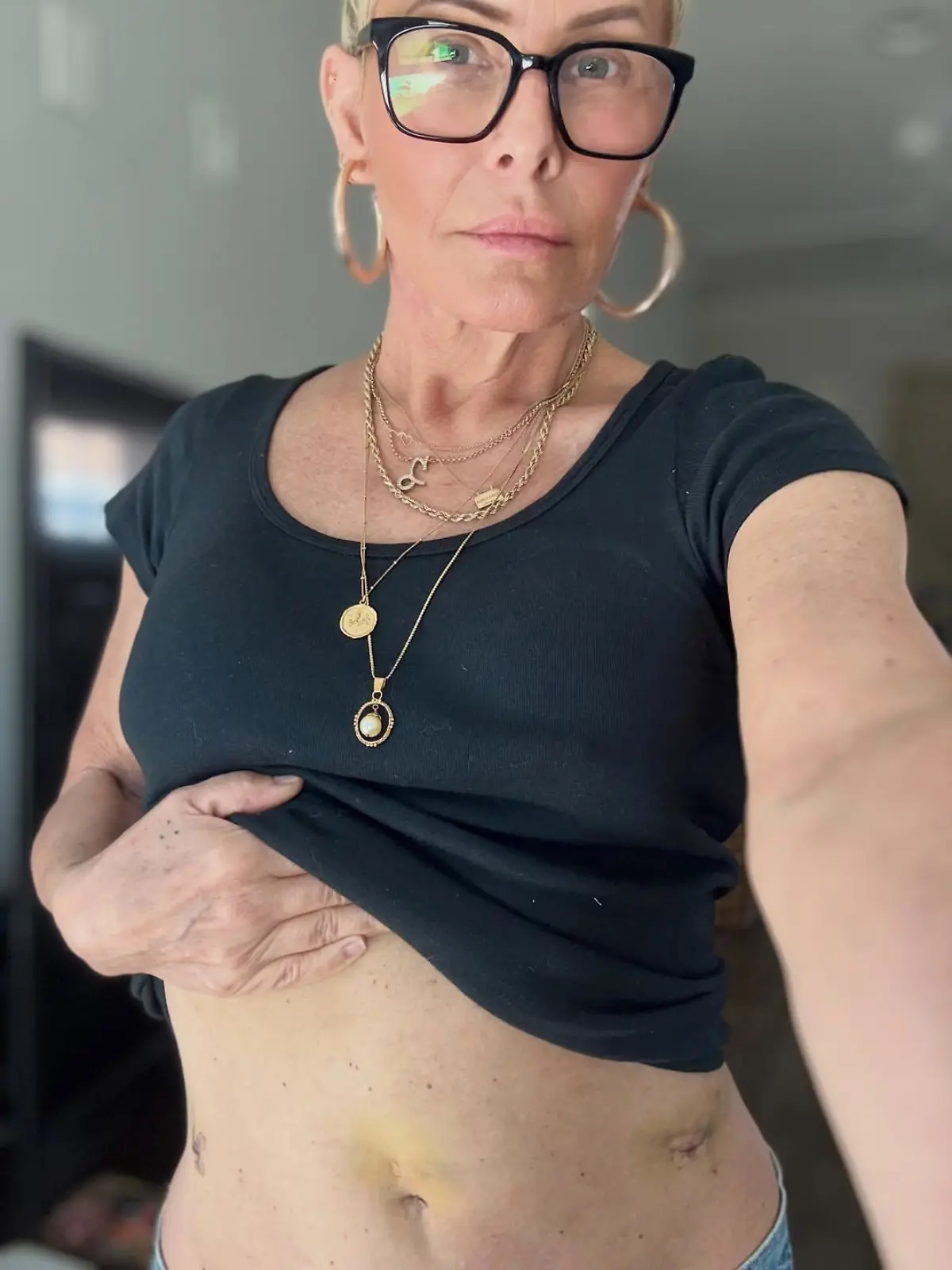 „Baywatch“-Star Nicole Eggert kämpft weiter gegen Krebs. 