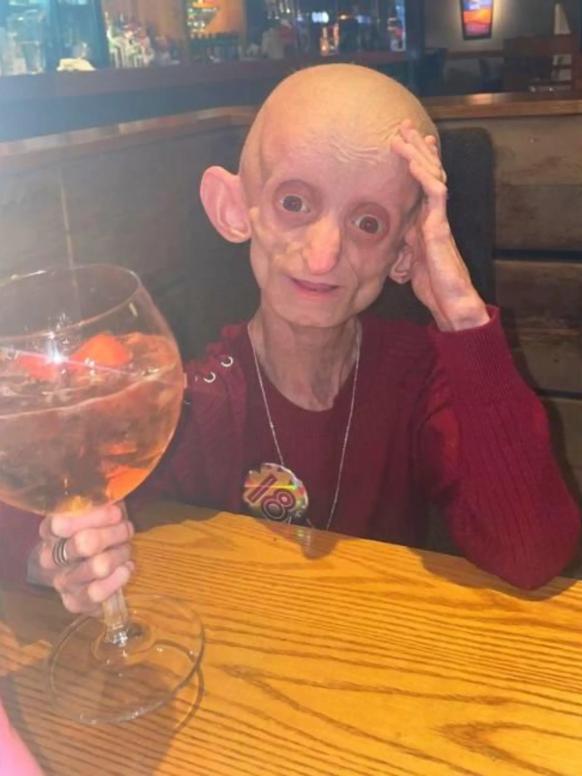 Benjamin Button Mädchen feiert Geburtstag