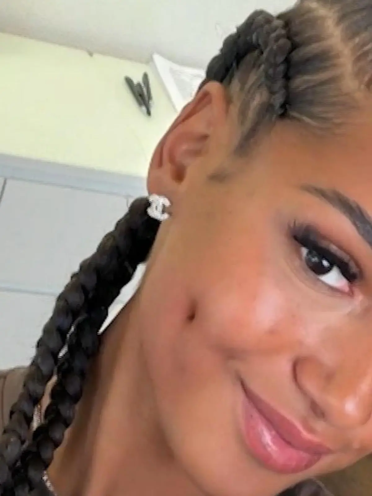 Bild zu: "Fans geschockt – weil sich Reality-Star an dieser Stelle operieren lässt!"